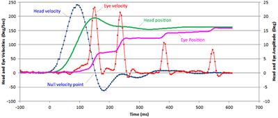 Visual Input Is the Main Trigger and Parametric Determinant for Catch-Up Saccades During Video Head Impulse Test in Bilateral Vestibular Loss